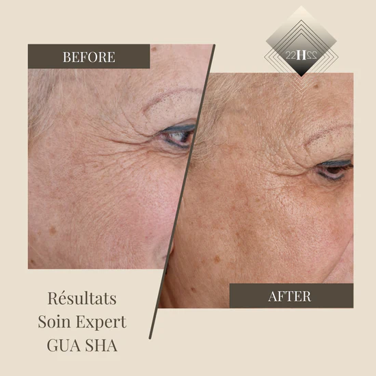 BEFORE_AFTER